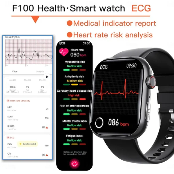 ECG & Blood Sugar Monitoring AI Medical Grade Smartwatch F100 - Image 4